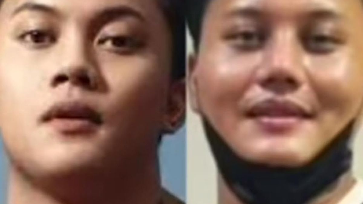 Tak Hanya Mahalini Rizky Febian Juga Lakukan Operasi Hidung Di Korea