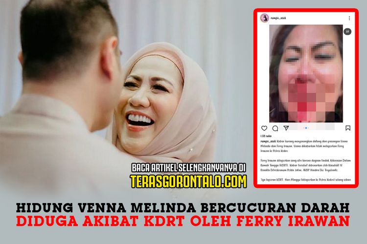 Hidung Venna Melinda Bercucuran Darah Diduga Akibat Kdrt Oleh Ferry Irawan Netizen Dulu Udah