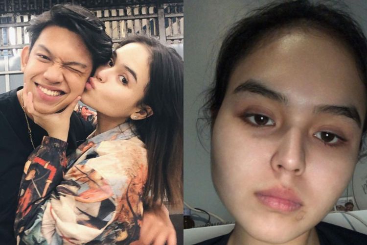 Gaga Muhammad Dituntut 4 Tahun 6 Bulan Penjara Kakak Laura Anna Beri