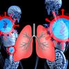 Researchers Call Covid-19 Patients' Lungs Better at Week 12, Damage Decreased 56 Percent