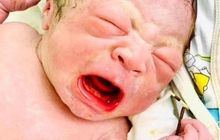 Viral Bayi Lucu Di Vietnam Ini Lahir Memegang Alat Kontrasepsi Ibunya Ringtimes Banyuwangi