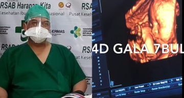 Dokter kandungan Vanessa Angel buka suara soal kelahiran Gala Sky.