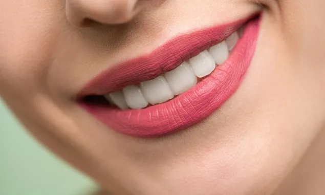 Punya Masalah Dengan Karang Gigi? Berikut 2 Bahan Alami Untuk Menghilangkan Plak Dan Karang Gigi
