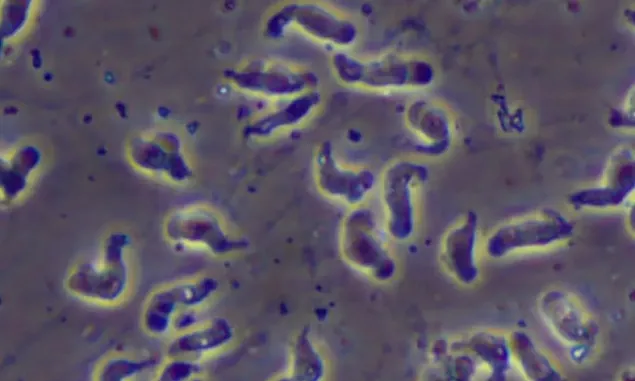 Hati-hati Naegleria Fowleri Amoeba Pemakan Otak yang Mematikan Bisa Ditemukan di 8 Tempat Ini