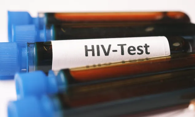 Waspada 6 Faktor Utama Penularan HIV Berikut, Ternyata Jarang Kita Sadari