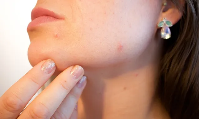 Wajib Tahu! Ini 5 Kandungan Bahan Skincare yang Aman Digunakan untuk Kulit Sensitif
