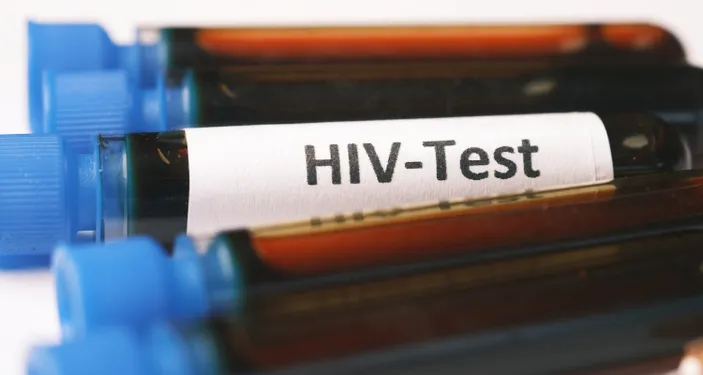 Apakah HIV Bisa Menyebar Lewat Darah yang Dibuang Sembarangan? Simak Penjelasan Dokter