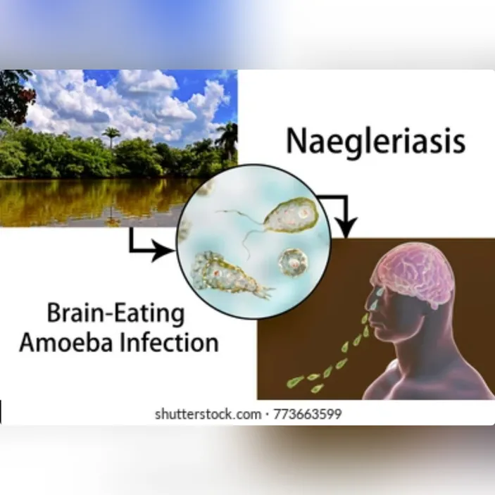 Awas Terinfeksi Naegleria Fowleri, Amoeba Pemakan Otak Hidup Di Air ...