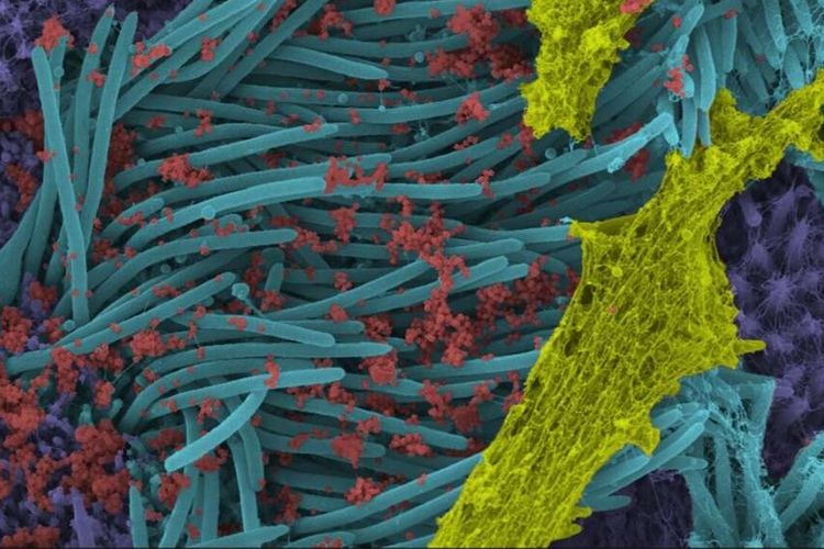 Horrified!  This is the Portrait of Covid-19 During Human Lung Cell Infection