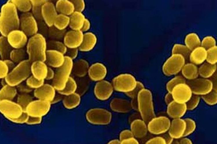 Biopharmaceutical Factory Leaks, Thousands of Chinese Citizens Affected by Brucellosis