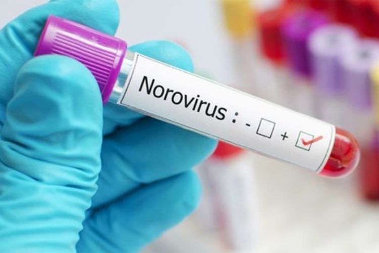 Norovirus Has Entered Indonesia, According To Internal Medicine