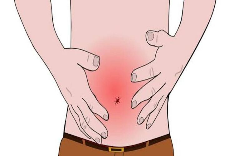 sakit perut bagian bawah pusar pada laki laki 7
