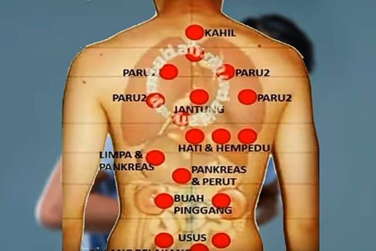 Mampu Menyembuhkan 72 Macam Penyakit Inilah Manfaat Bekam Menurut