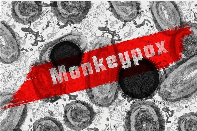 ALERT!  Monkeypox has entered a number of countries, recognize the symptoms and causes