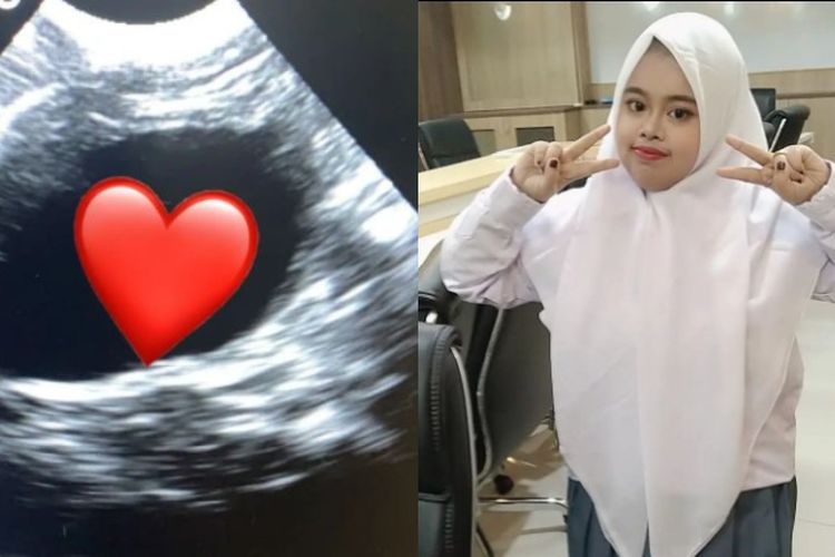 Kekeyi Mendadak Hamil Unggah Foto Usg Di Instagram Netizen Key Lu