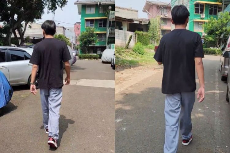 Dokter Ungkap Peluang Sembuh David Ozora: Otak Bermasalah, Kekuatan Tangan dan Kaki Terganggu