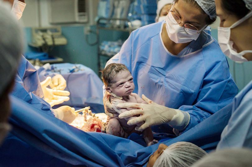 Video Yg Aneh Bayi Lahir Viral Bayi Baru Lahir Tampakkan Ekspresi Marah kepada 