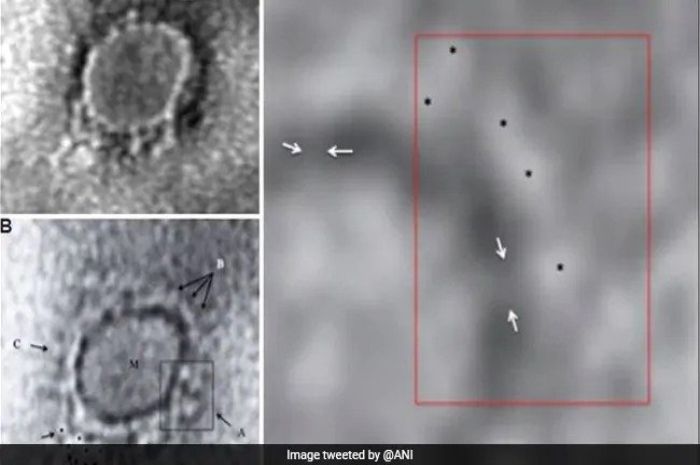 noget blod madras India Rilis Gambar Mikroskop Elektron Pertama yang Diduga Virus Corona