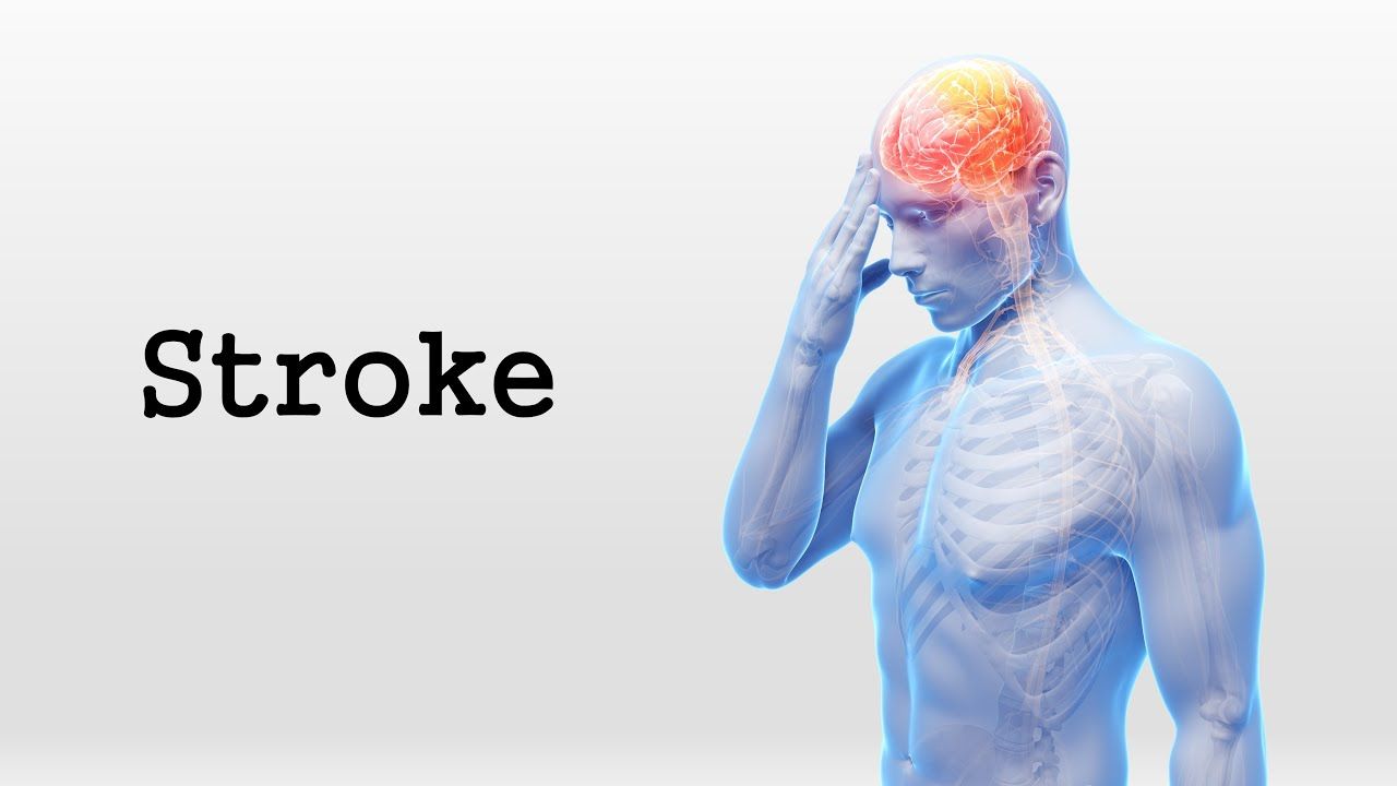 Peringatan Hari Stroke Sedunia, Waspada dan Ketahuilah ...