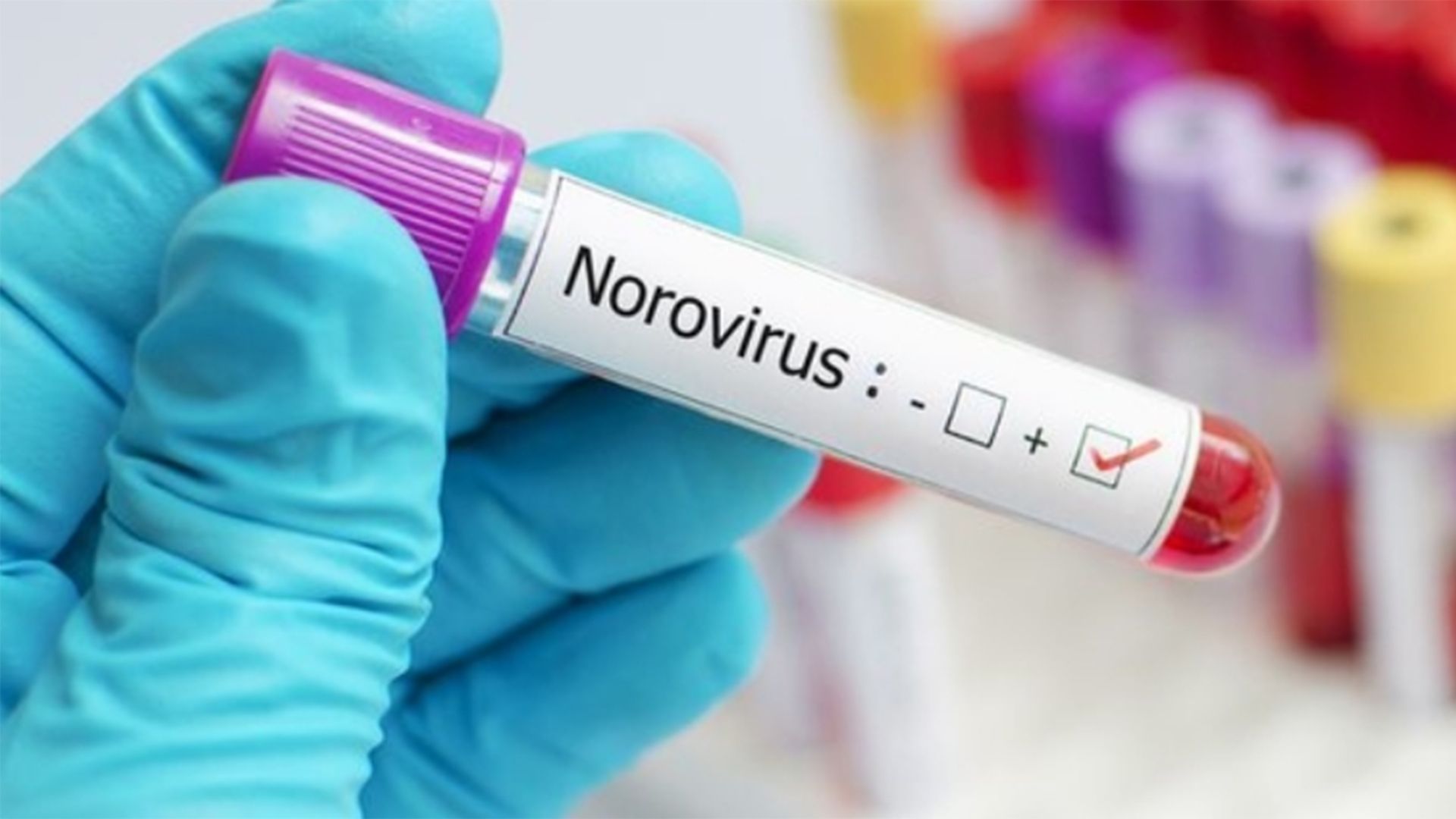 Norovirus Sudah Masuk Indonesia, Ini Menurut Ahli Penyakit Dalam - Fix Indonesia