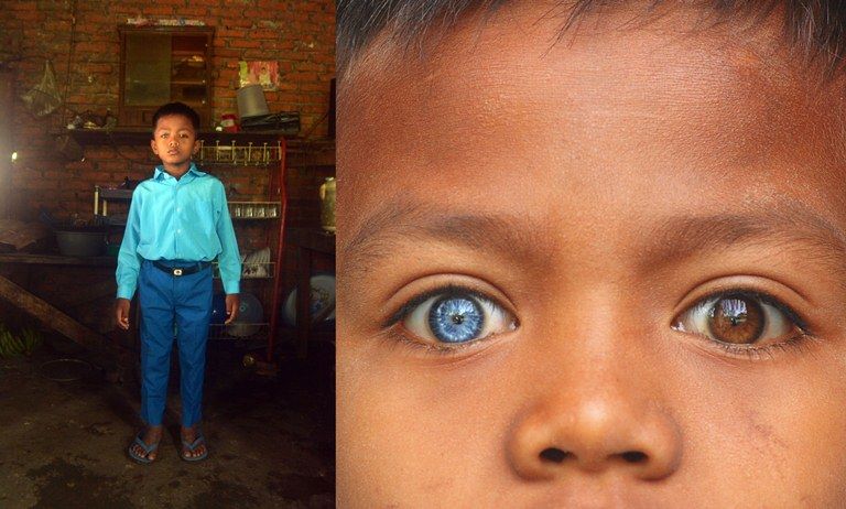 Anak Sumatera Barat bermata biru