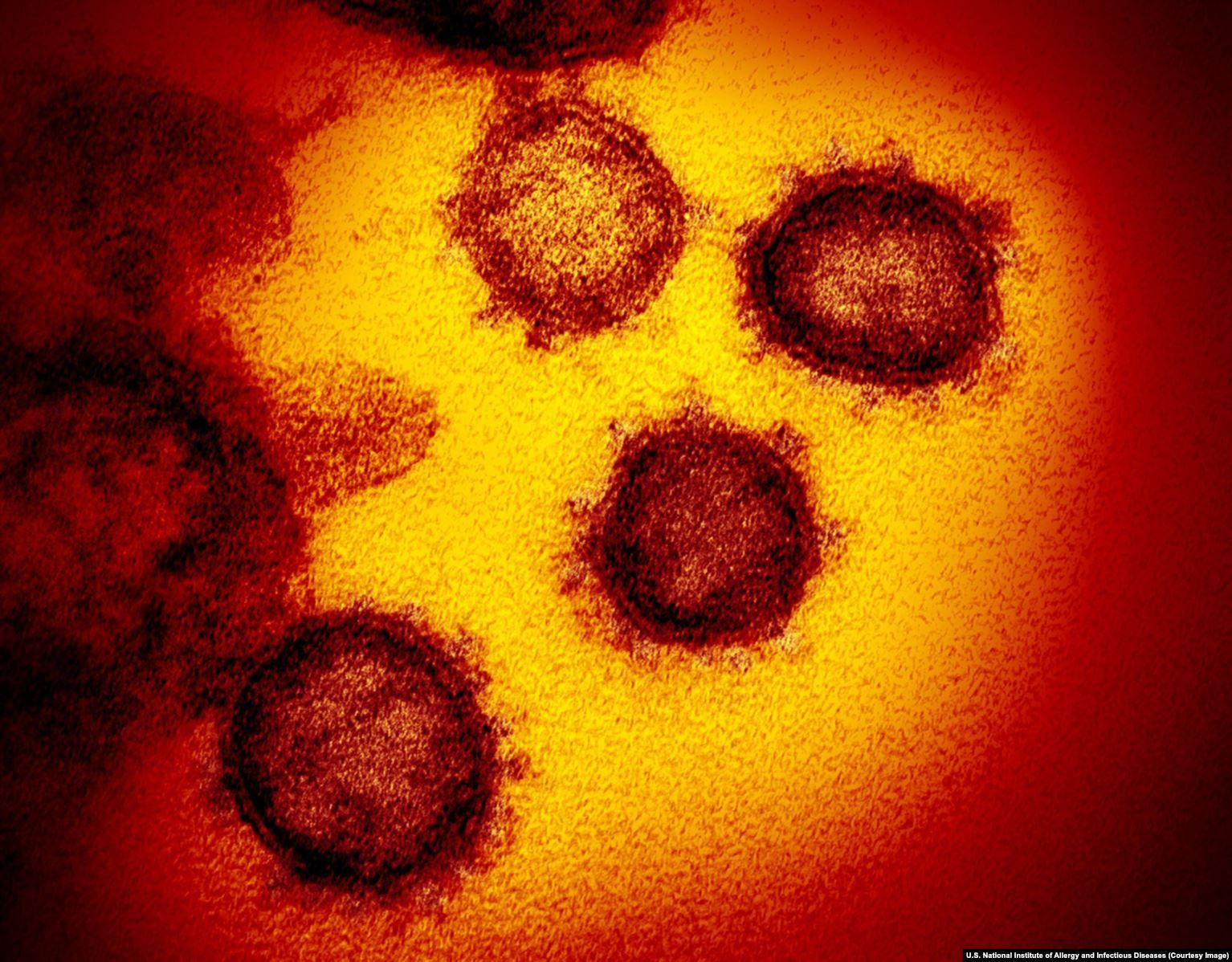 Potret virus corona SARS-Cov-2 di bawah mikroskop.