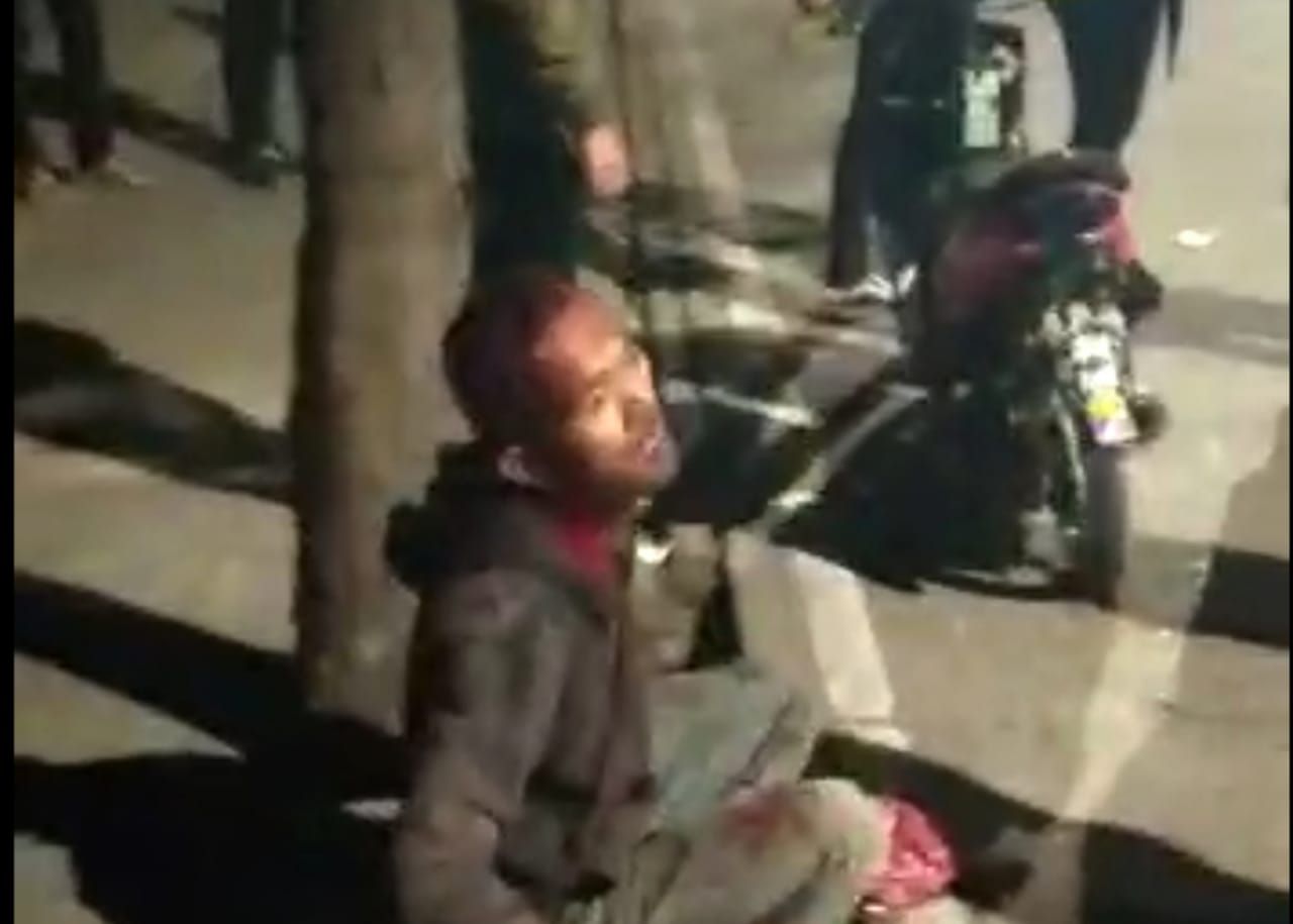 Dani Rustandi korban pembacokan begal motor di Bandung
