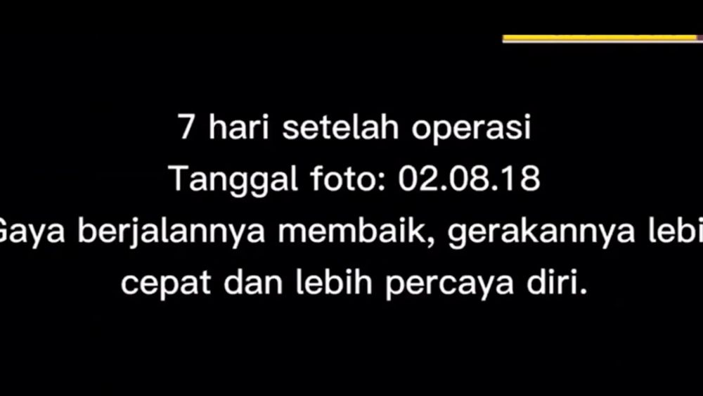 Di akhir video Dayana menjelaskan bagaimana kondisinya 7 hari setelah operasi dalam Bahasa Indonesia.