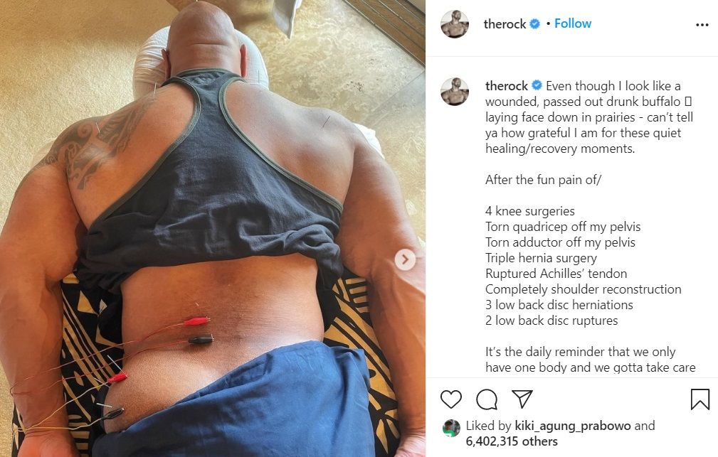 Unggahan Dwayne Johnson di instagram saat menjalani terapi akupuntur akibat cedera