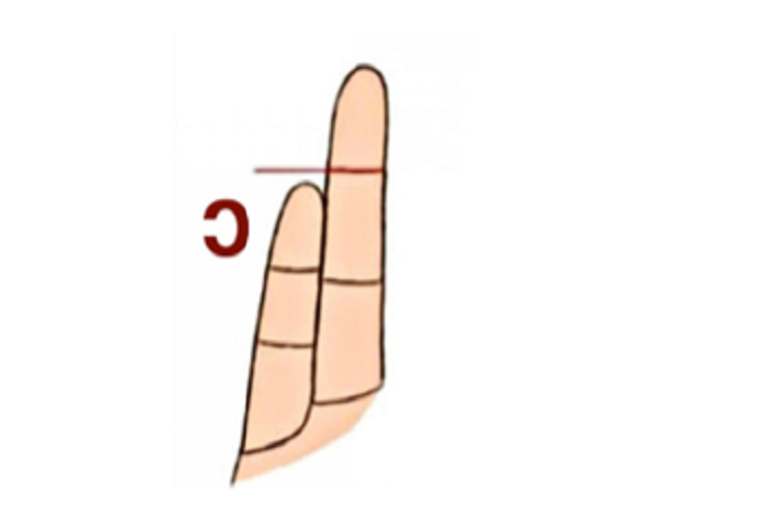 Panjang jari kelingking yang pendek dibandingkan dengan ruas jari manis