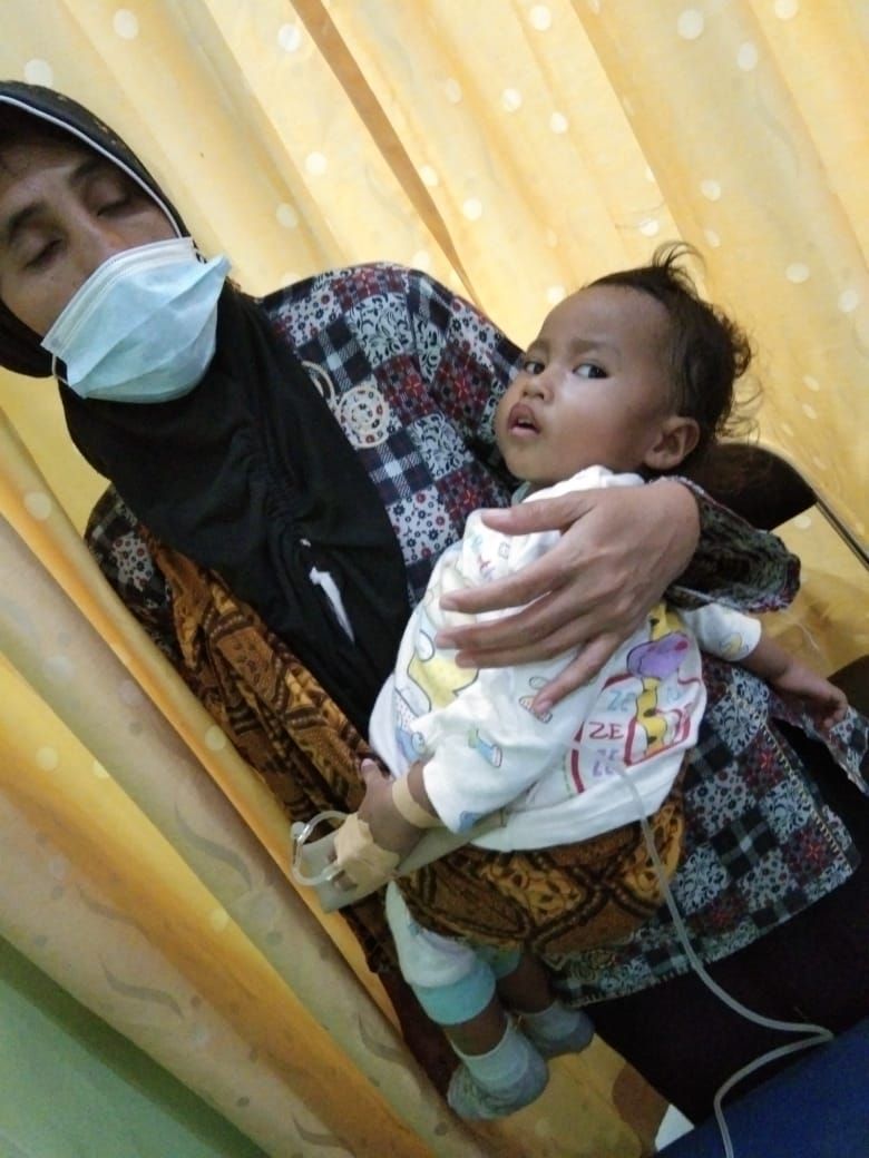 Dea Alivia (3) warga Cinunuk yang mengalami gizi buruk, terjangkit TBC paru dan TBC tulang yang kini dirawat di RSUD Ujungberung Kota Bandung membutuhkan uluran tangan. 