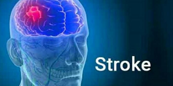  Ilustrasi penyakit stroke