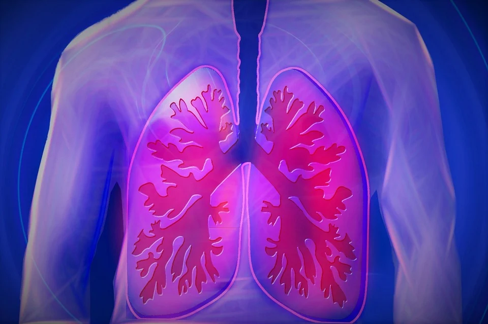 Ilustrasi paru-paru manusia.
