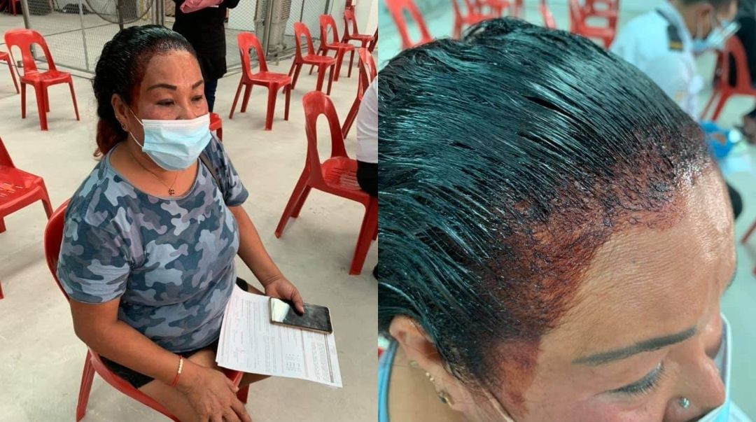 Ibu di Malaysia nekat datang ke tempat vaksinasi Covid-19 meski semir rambutnya belum kering agar tidak terlambat