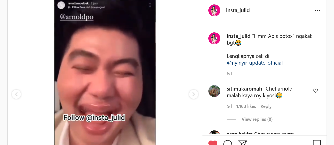 bibir Chef Arnold mampu membuat netizen tertawa ngakak