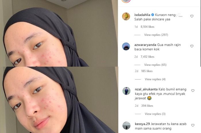 Tangkapan layar komentar Iis Dahlia dan netizen yang menuding Nissa Sabyan tengah hamil.