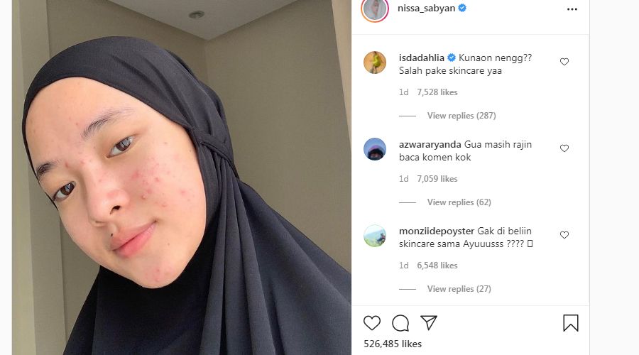 Nissa Sabyan Posting Foto Wajah Tanpa Makeup dan Natural, Iis Dahlia Komentar: Salah Pake Skincare Yaa