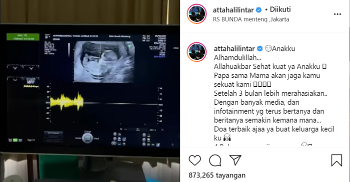 Unggahan Atta Halilintar terkait kehamilan Aurel Hermansyah.