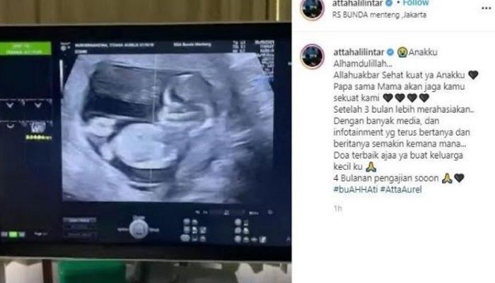 Unggahan Akun Instagram Atta Halilintar Mengenai Kehamilan Istrinya, Aurel Hermansyah