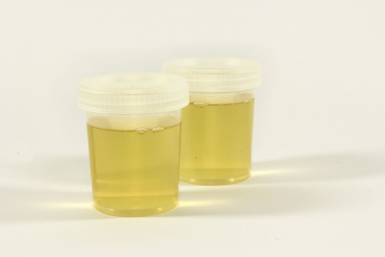 Jumlah urine mempengaruhi pengeluaran yang adalah tidak faktor GINJAL (PEMBENTUKAN