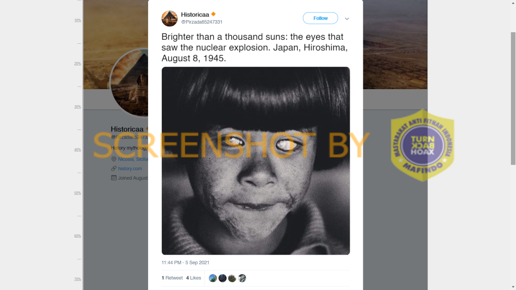 Beredar foto yang diklaim menunjukkan wajah anak korban bom Hiroshima, Jepang pada 8 Agustus 1945, ini cek faktanya.