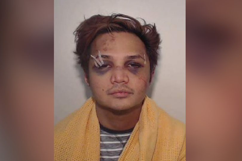 Kepolisian Inggris Rilis Foto Reynhard Sinaga Saat Pertama Kali Ditangkap, Wajahnya Babak Belur & Penuh Lebam