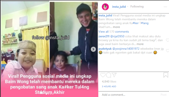 Tuai Banyak Kritikan, Viral Video Baim Wong Membantu Seorang Anak Sakit Kanker Tulang