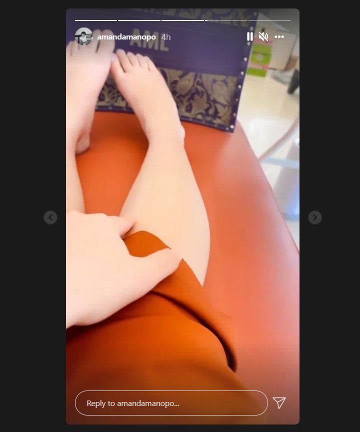 Amanda Manopo Curhat Lutut Bengkak, Malah Disumpahi Patah Kaki Hingga Disebut sebagai Pelakor