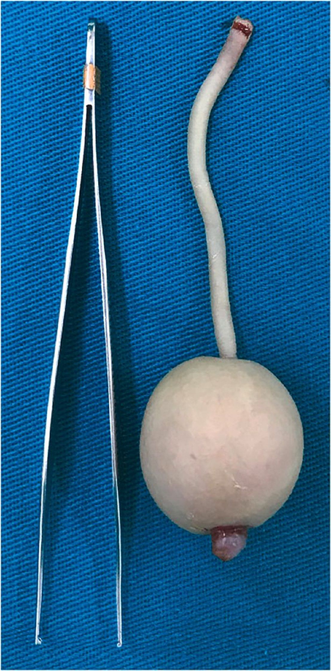 Bola di ujung tali daging itu terdiri dari lemak dan jaringan embrio.   