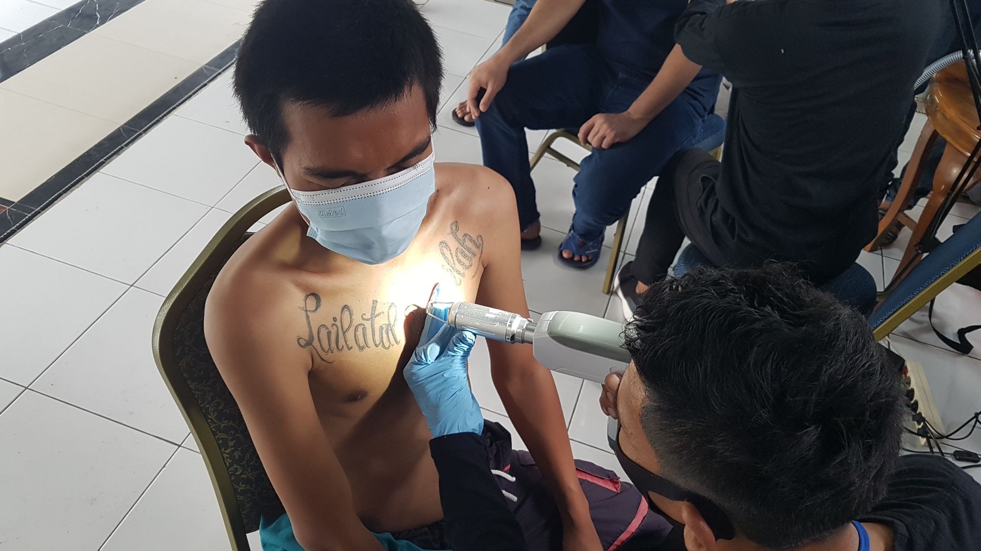 Proses penghapusan tato kepada warga binaan Lapas Karawang