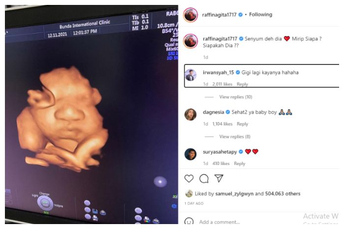 Netizen kompak menebak mirip siapa calon anak kedua Raffi Ahmad dan Nagita Slavina usai keduanya memperlihatkan hasil USG sang bayi.*