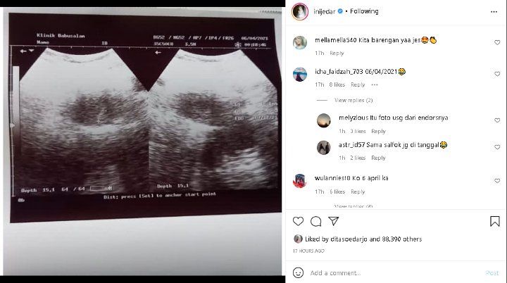 Baru Saja Umumkan Kehamilan, Tanggal Postingan USG Milik Jessica Iskandar Bikin Salah Fokus