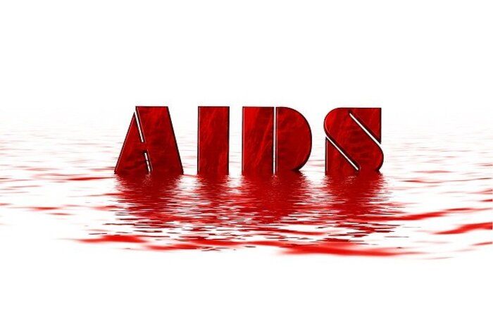 HIV/AIDS apakah bisa sembuh dan Apa saja Gejalanya? Simak Penjelasan dr. Clarin Hayes.