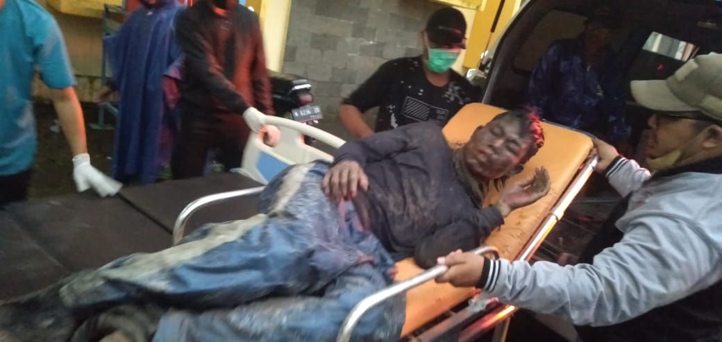 Salah seorang warga korban erupsi Gunung Semeru yang mengalami luka bakar sedang ditangani tim medis